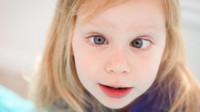 criança "vesga" - estrabismo