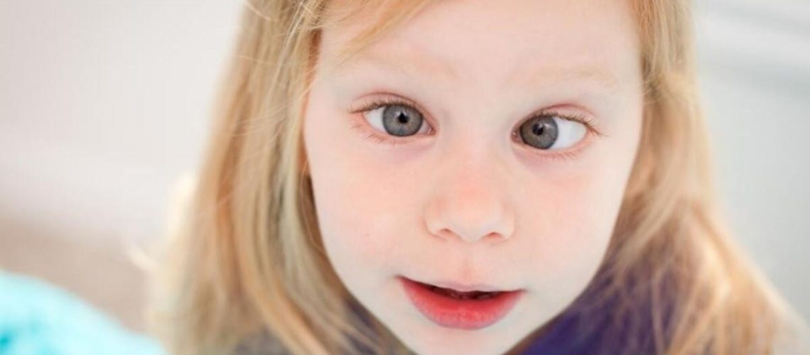 criança "vesga" - estrabismo